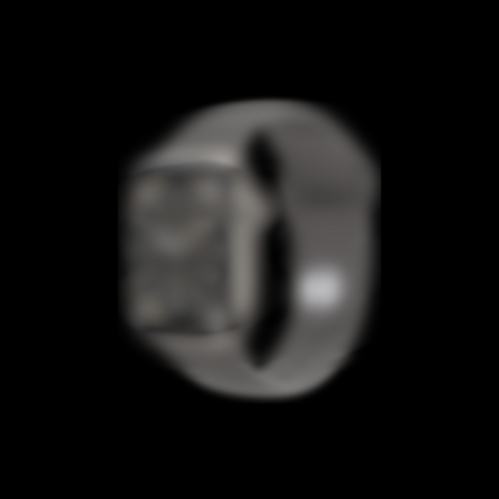 A WATCH SRS 10